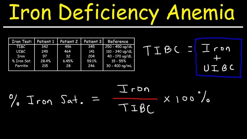 آزمایش TIBC