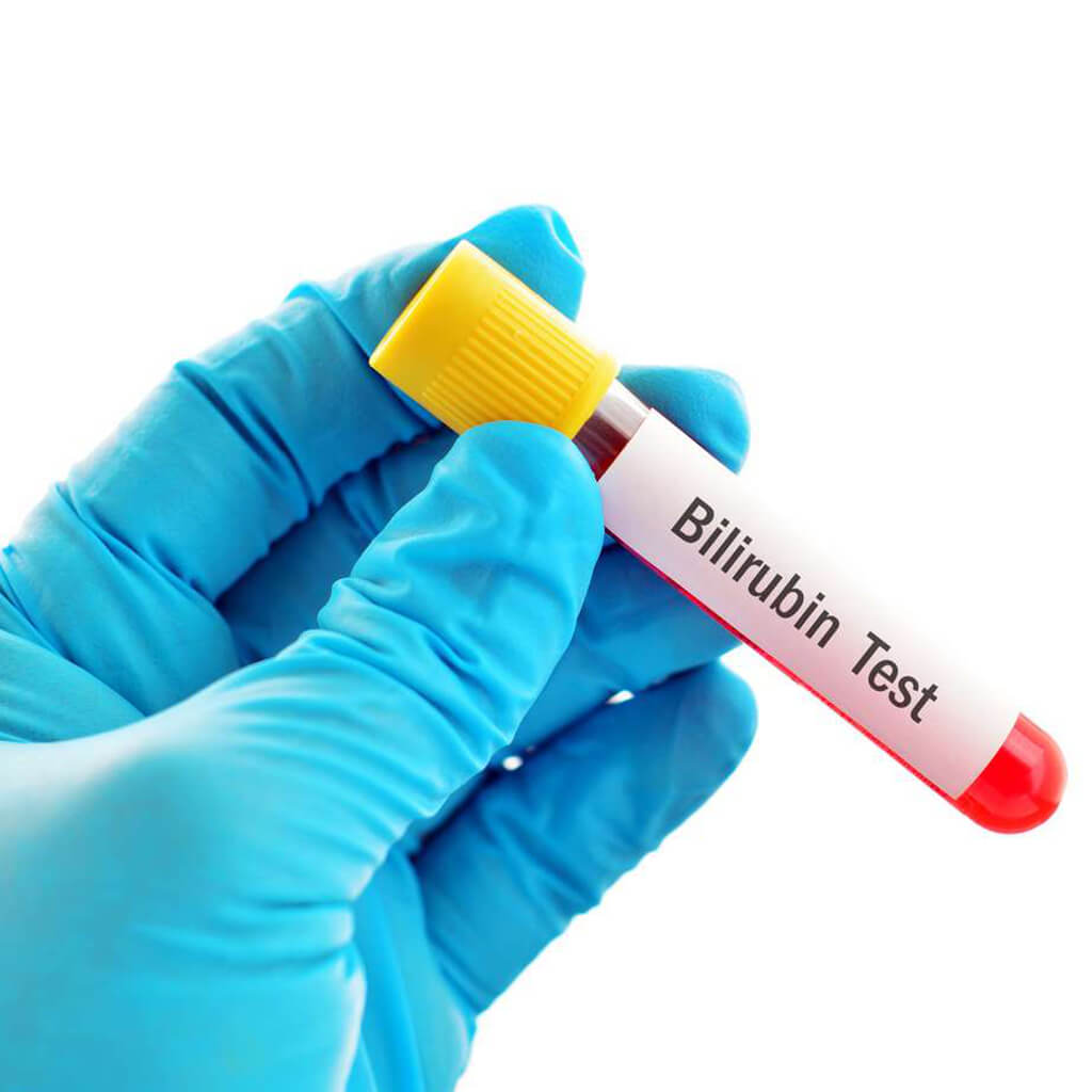 bilirubin-Thumb