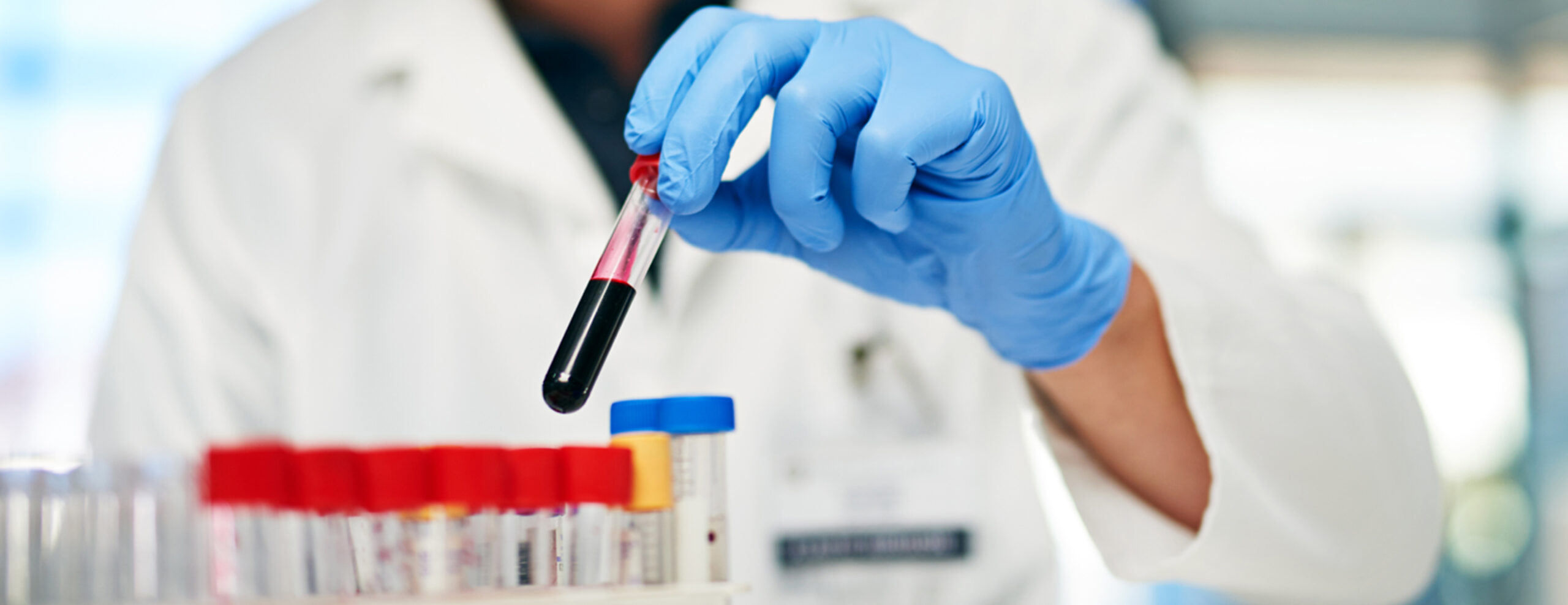 digoxin-test-2x