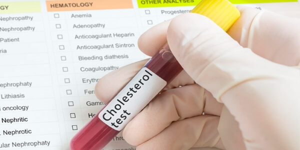 lowering-Cholesterol1